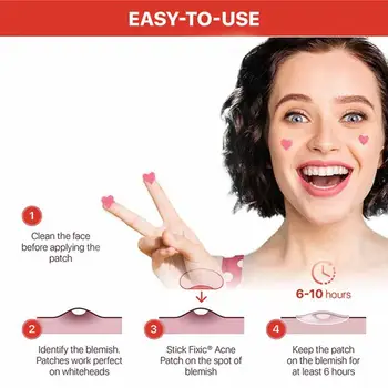 Espinha Patch Adesivos Lugar Tratar De Espinha De Removedor De Ferramenta De Defeito Lugar Facial Cobertura De Cuidados Com A Pele